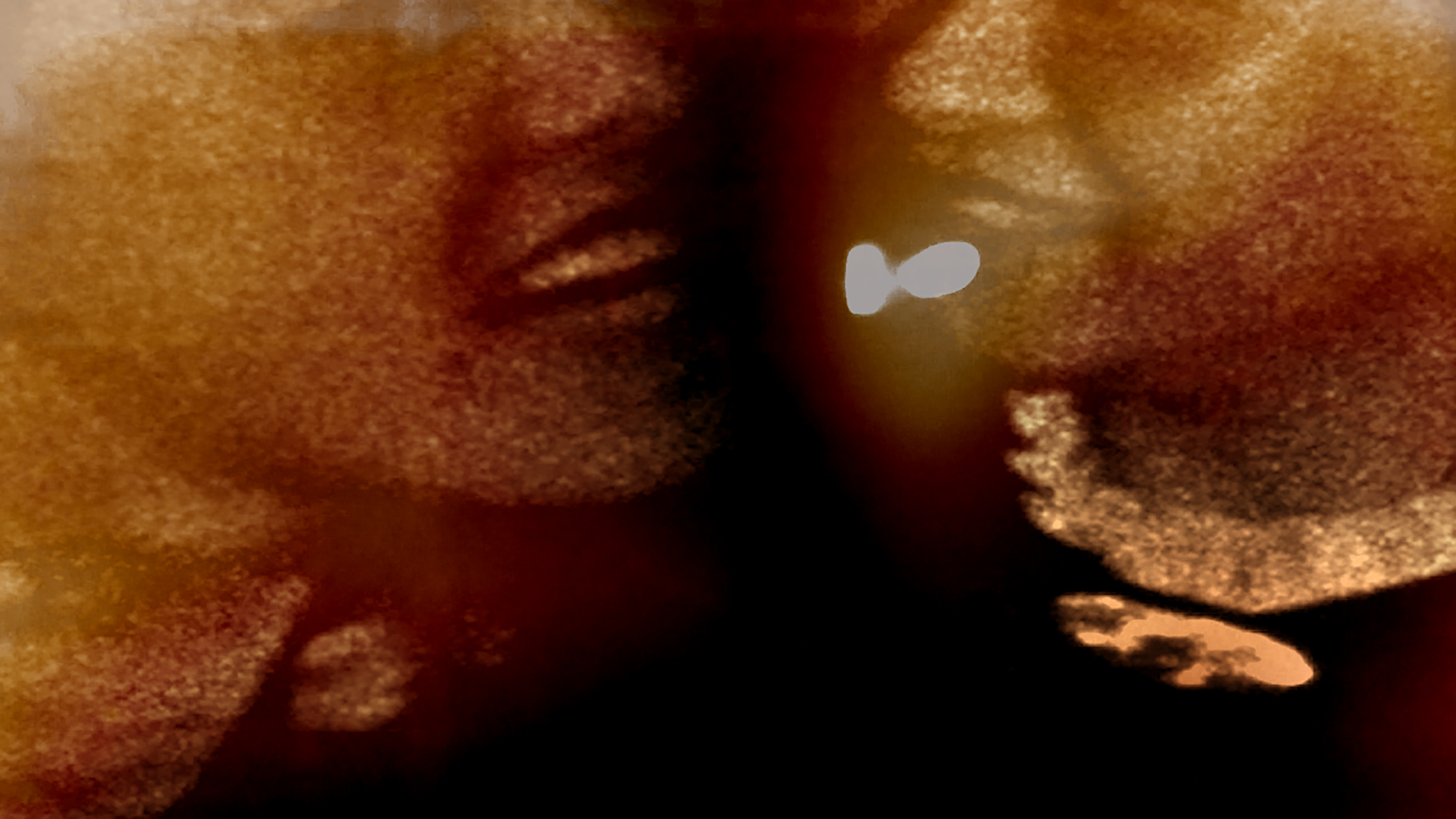 An image of two men showing the bottom half of their faces
